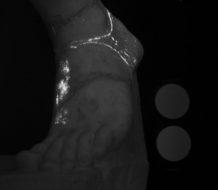 A visible-induced infrared luminescence (VIL) image showing the foot of an Amazon