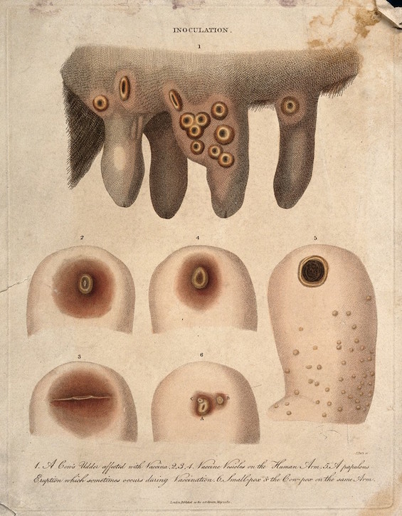 A milk maid shows her cowpoxed hand to a physician, while a farmer or  surgeon offers to a dandy inoculation with cowpox that he has taken from a  cow. Coloured etching, ca.