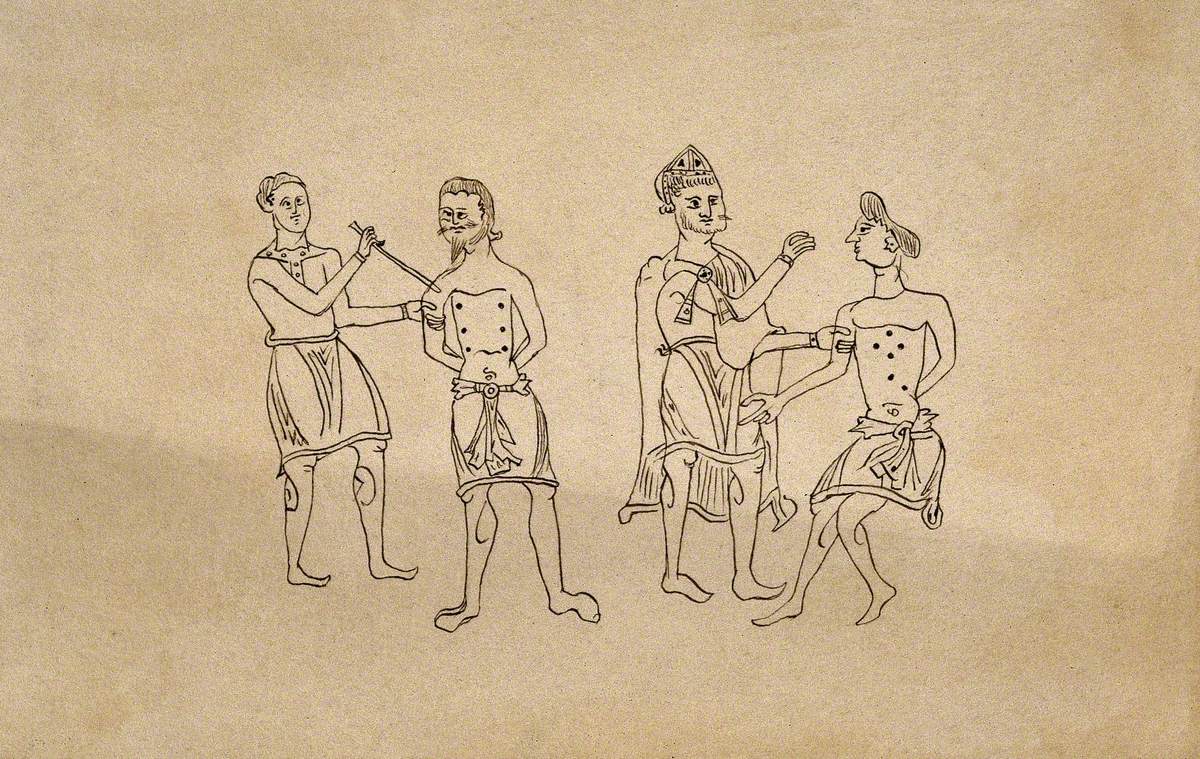 Two Surgeons Applying the Method of Cauterisation to Clearly Defined Points on the Chests of Two Male Patients, the Senior Surgeon Wears a Pointed Hat (?)