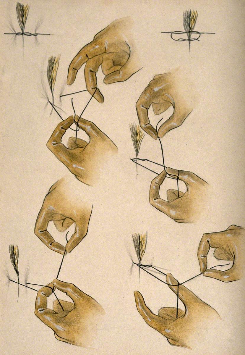 Surgical Stitches