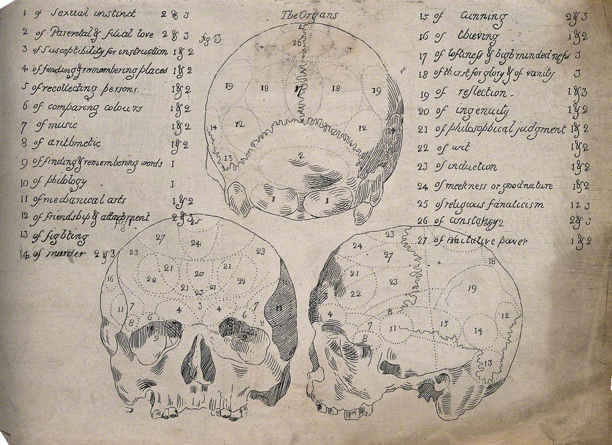 Three Perspectives of a Skull Sectioned and Labelled According to an Unorthodox System of Phrenology