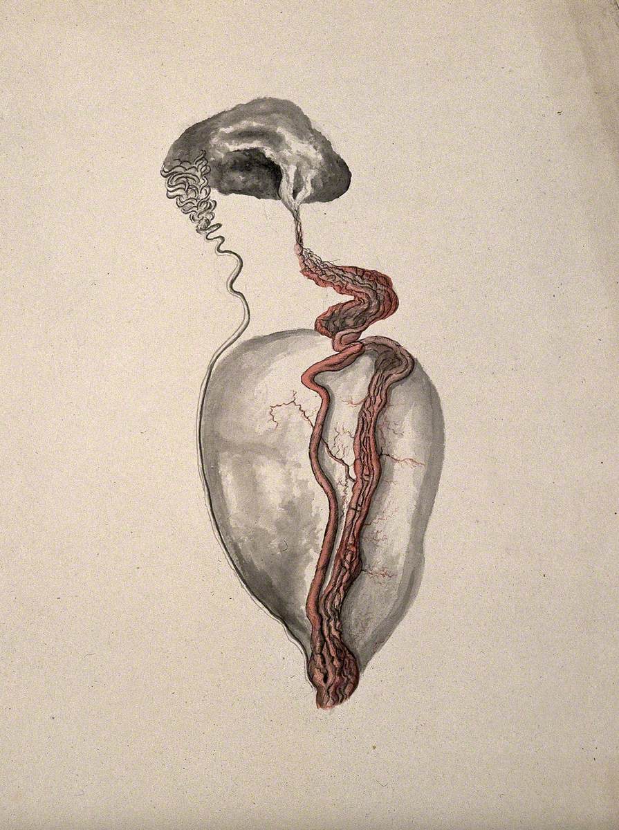 A Diseased Part of the Body