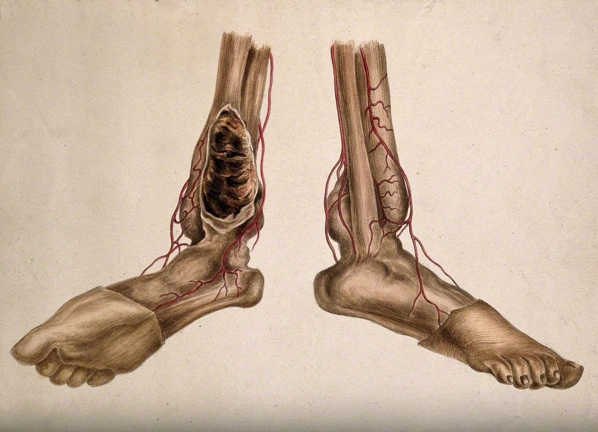 A Pair of Dissected Feet