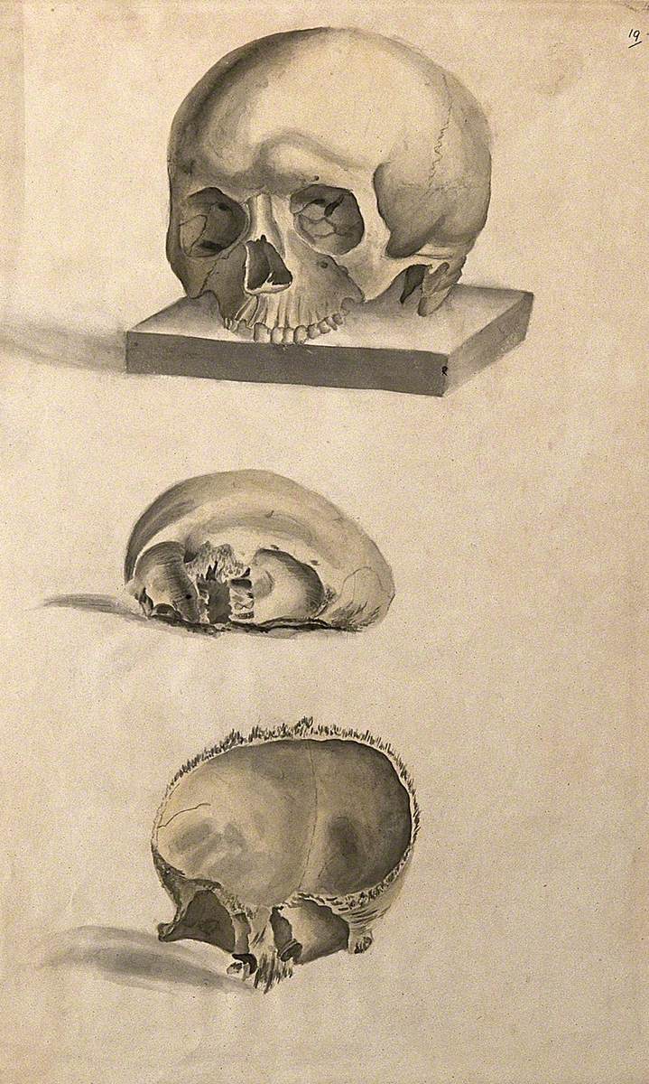 Human Skull: Three Figures Showing Sections and an Entire Skull
