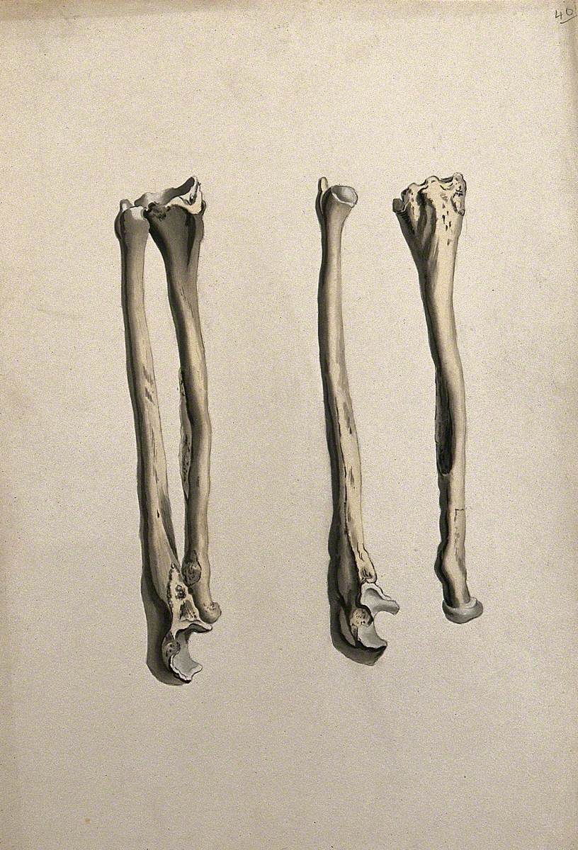 Radius and Ulna Bones: Two Figures