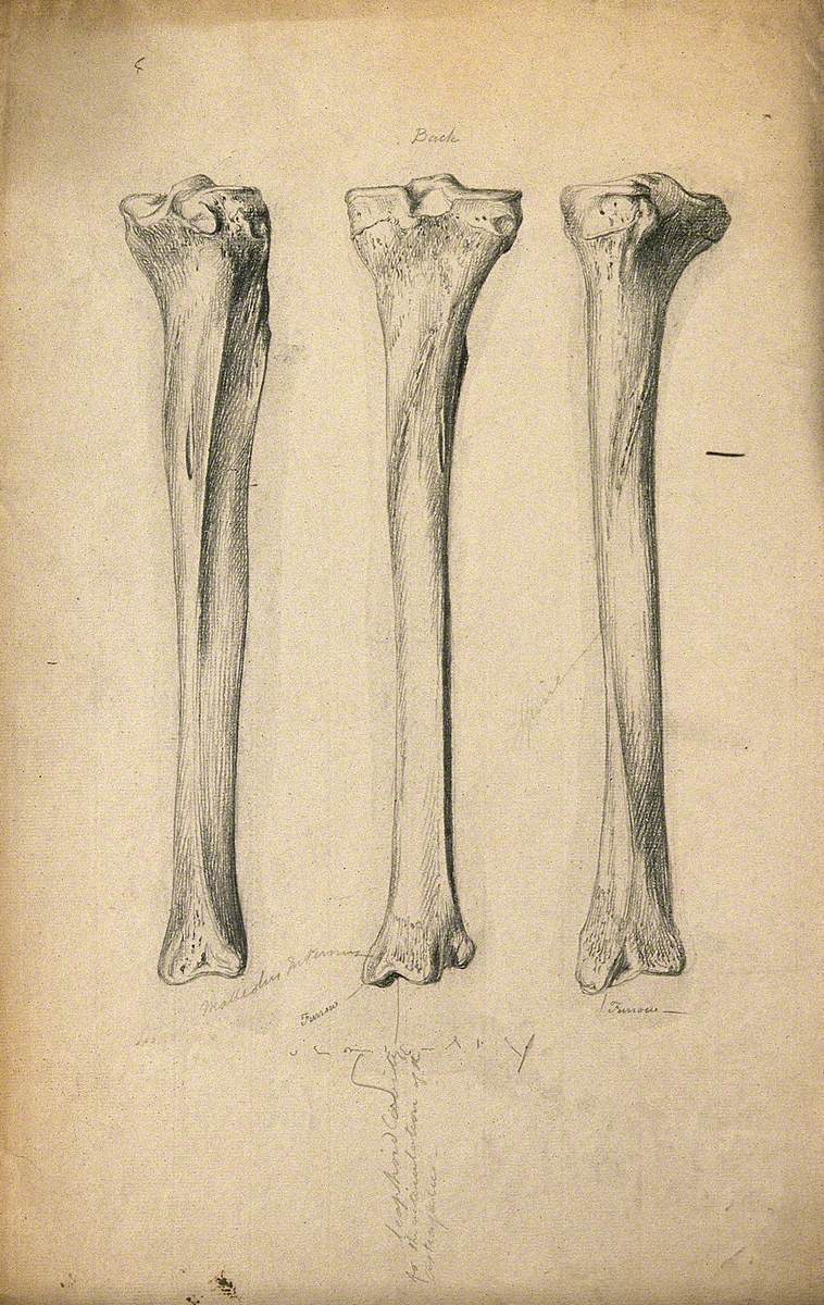 Tibia Bones: Three Figures