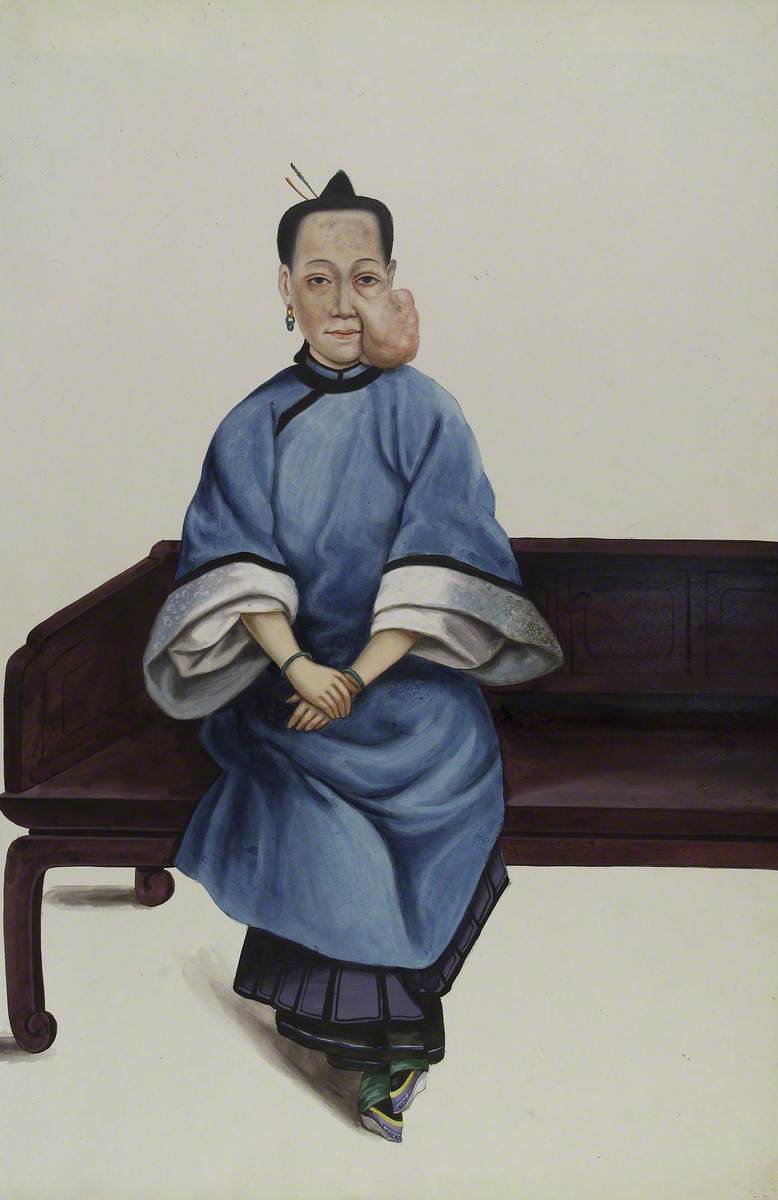 A Woman (Lo Wanshun) with a Tumour on Her Left Cheek