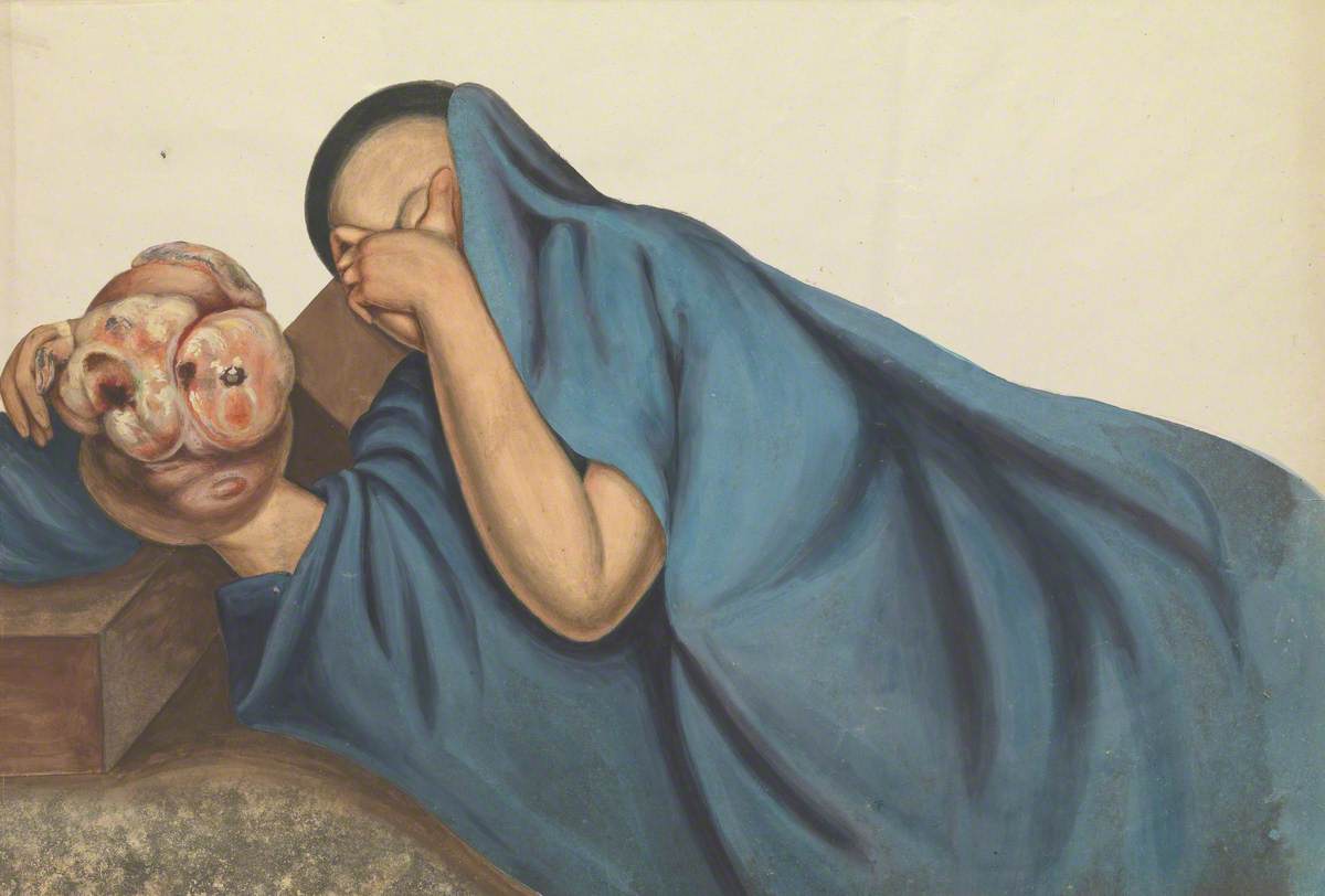 A Woman (Leang Yen?) with a Large Tumour on Her Right Hand, Reclining and Concealing Her Face