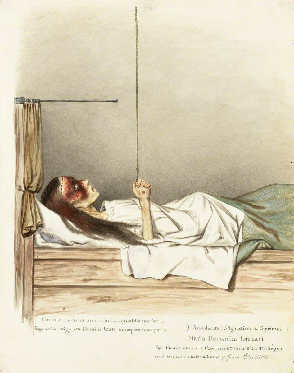 Maria Domenica Lazzari (Lazzeri), a Girl with Stigmata on Her Hands