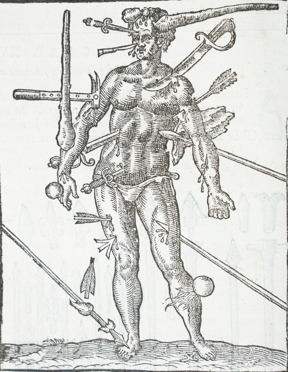 Wound Man