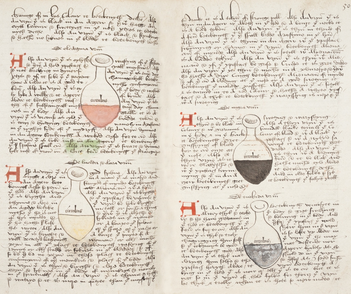 Medieval Urine Analysis