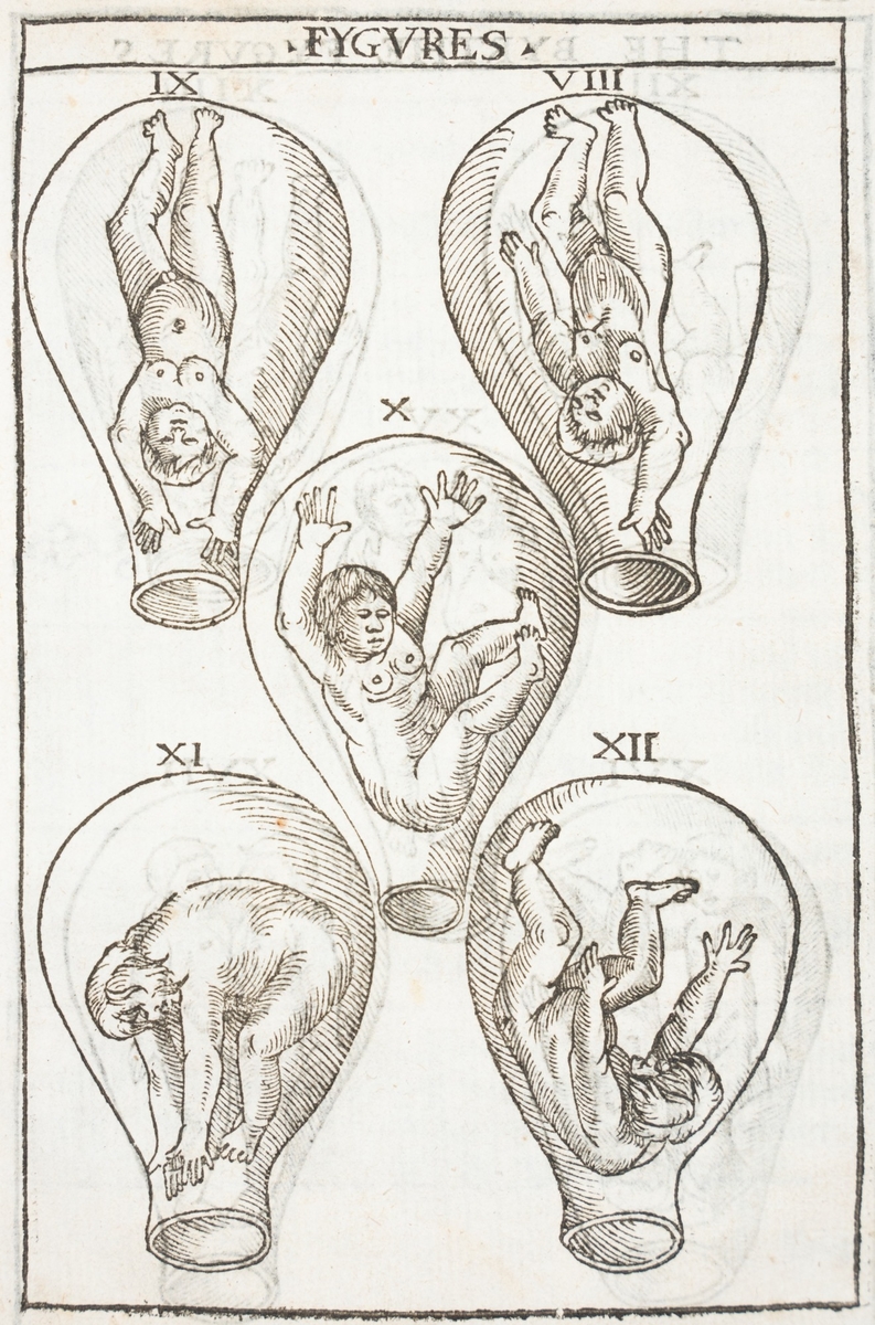 Foetuses in the Womb