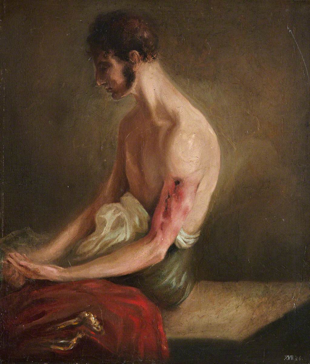 The Wounded following the Battle of Corunna: Gunshot Fracture of Shaft of Humerus