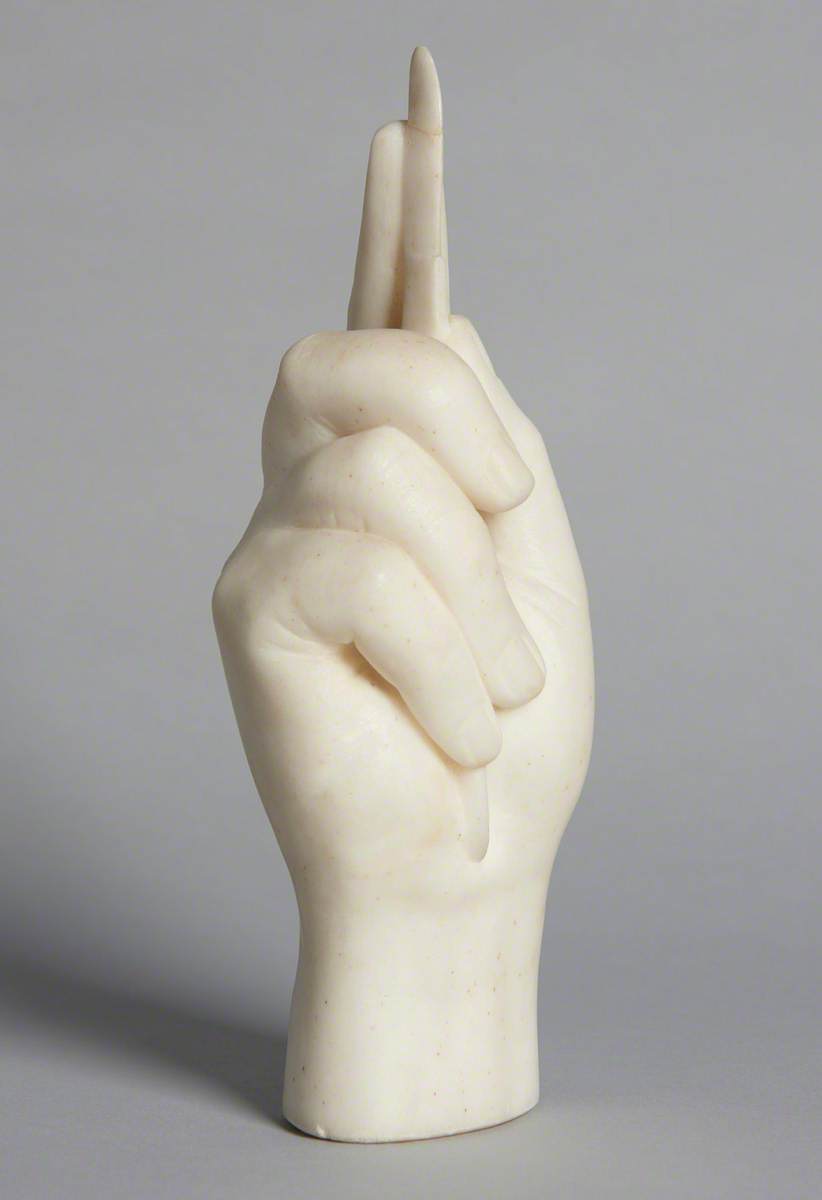 James Syme's Right Hand Holding a Scalpel