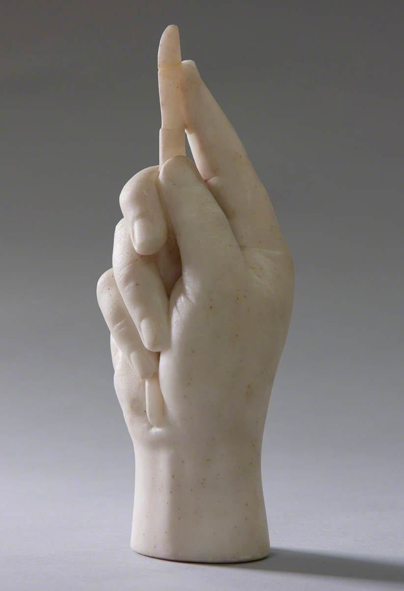 James Syme's Right Hand Holding a Scalpel