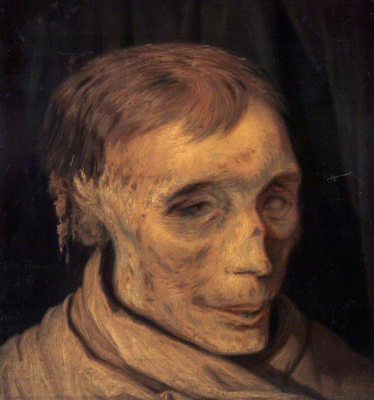 James Hepburn (c.1535–1578), 4th Earl of Bothwell, Third Husband of Mary, Queen of Scots (Study of Mummified Head)