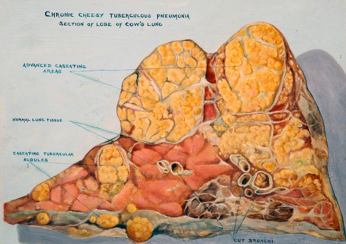 Section of a Lobe of a Cow's Lung: Chronic Cheesy Tuberculous Pneumonia