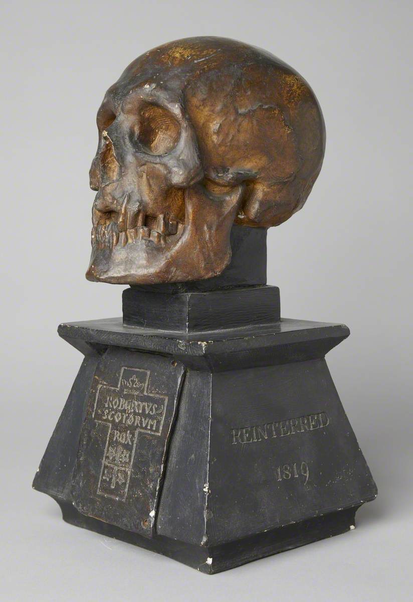 Cast of the skull of Robert the Bruce (1274–1329)