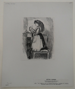 After Burns