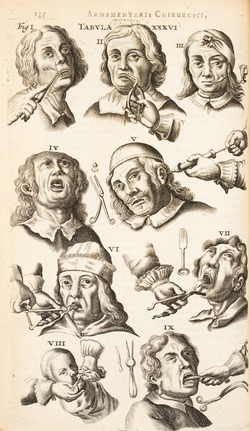 Nine Heads Getting Teeth Extracted and Ears Syringed