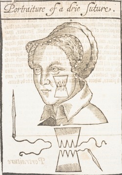 Portrait of a Woman's Face Receiving a Dry Suture