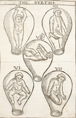 Foetuses in the Womb