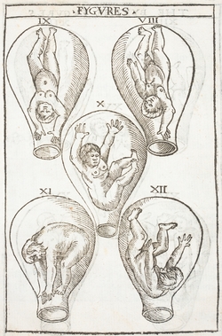 Foetuses in the Womb