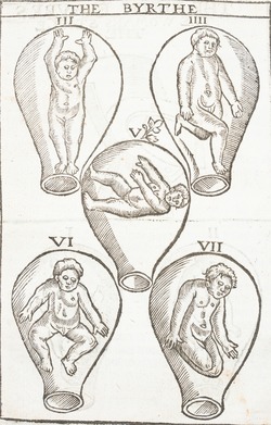Foetuses in the Womb
