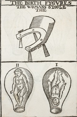 Foetuses in the Womb and Birthing Chair