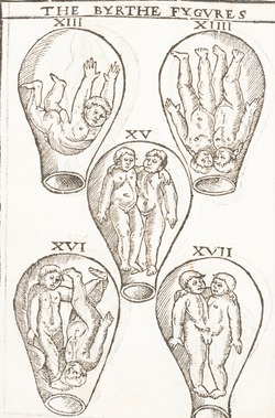 Foetuses in the Womb