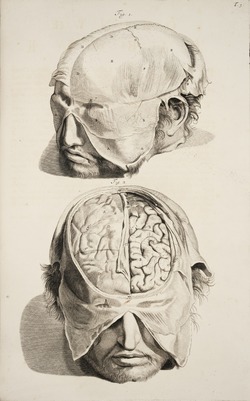 Dissected Heads
