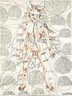 Wound Man