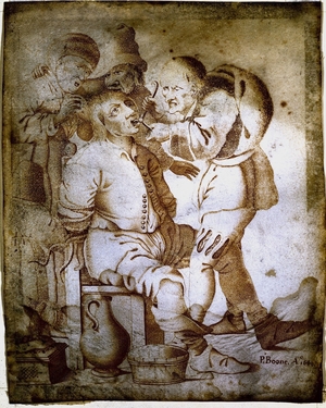 An Operator Pulling a Tooth; Representing the Sense of Touch