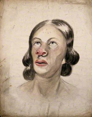 Head of a Woman with a Disease Affecting Her Nose