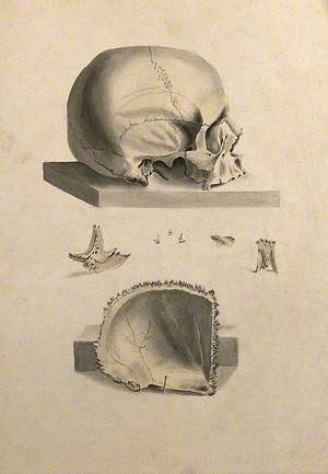 Human Skull: Six Figures Showing Sections and an Entire Skull
