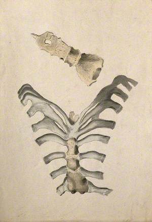 Ribs and Sternum: Two Figures