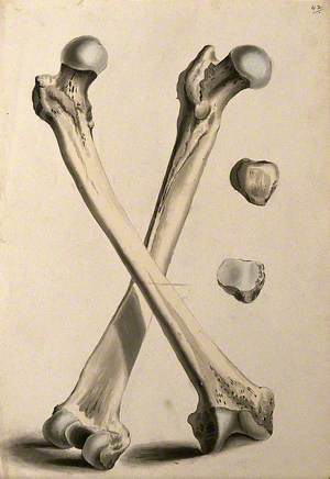 Crossed Femurs (Thigh Bones)