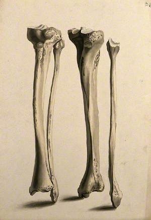 Tibia and Fibula Bones