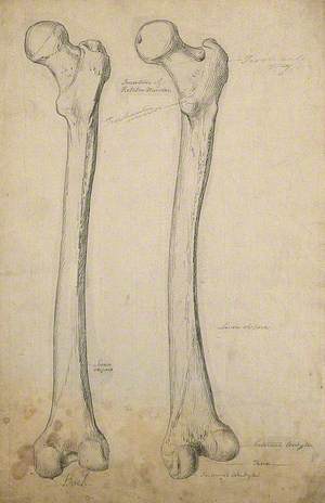 Right Femur (Thigh Bone), Back View: Two Figures