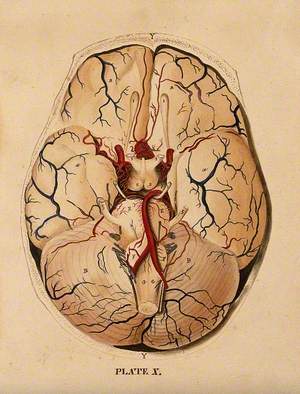 Brain: Dissection Showing the Base of the Brain