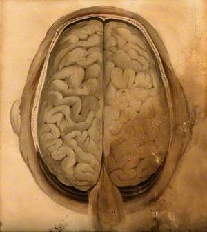 Brain: Dissection Showing the Gyri, Seen from Above