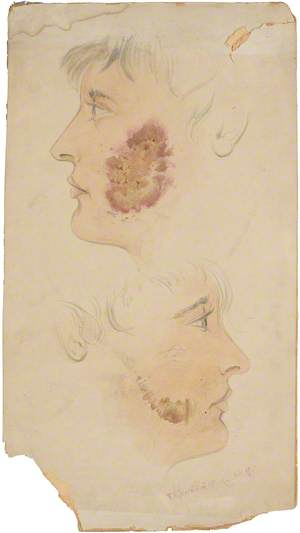 Face of a Man with Skin Disease: Two Figures