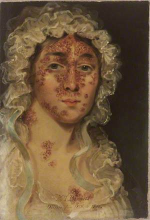 Mrs Bennett, Afflicted with a Skin Disease
