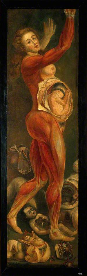 A Pregnant Woman, Dissected, Lateral View, with Arms Upraised, Accompanied by Separate Sections of the Body