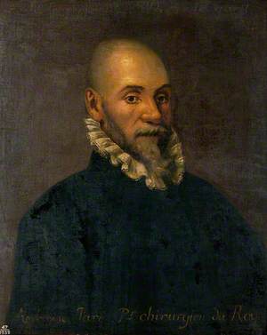 Ambroise Paré (1510–1590), Surgeon