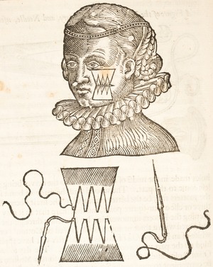 Portrait of a Woman's Face Receiving a Dry Suture