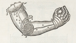 Artificial Arm
