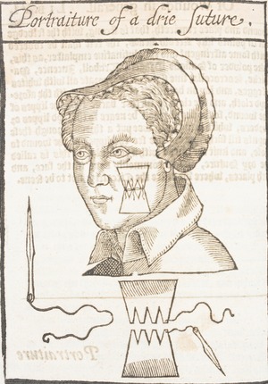 Portrait of a Woman's Face Receiving a Dry Suture