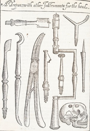 A Trepan with Other Instruments for the Head