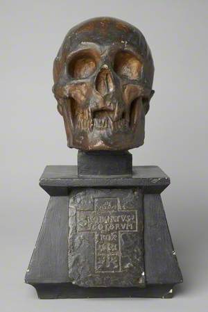 Cast of the skull of Robert the Bruce (1274–1329)